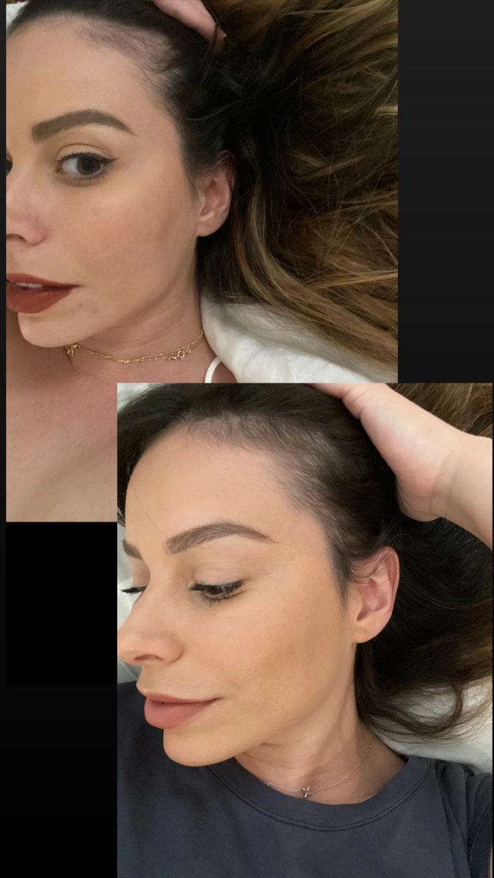 Volume restoring office hairstyle for postpartum hair loss, side view