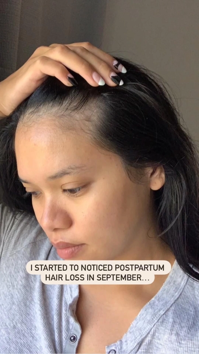 Professional office hairstyle with added volume for postpartum hair loss