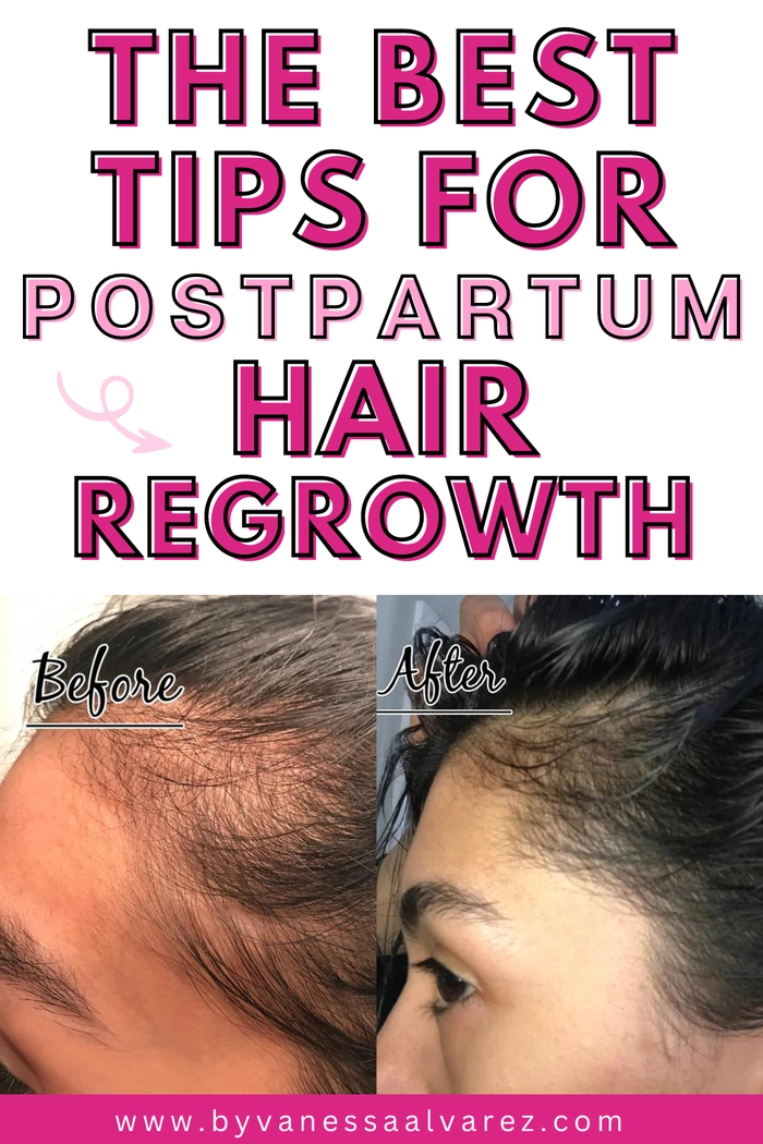 Postpartum Hair Loss: Volume-Restoring Office Styles